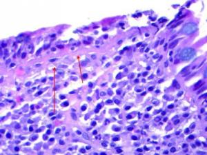 Микроскопска картина на тропическа спру