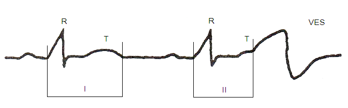 R върху Т-феномен