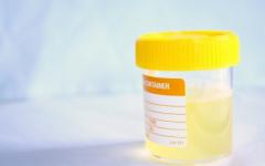 Простуда, стрес и хормонални нарушения отварят вратата пред цистита