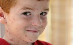 Дете с шарка