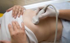 Сравняват изкарването на камъка с раждане