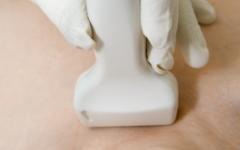 На практика непознатите у нас тиреоидити на Хашимото станаха масово явление