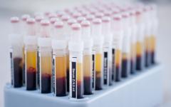 Салицинът е натурално съединение, структурно сходно с ацетилсалициловата к-на