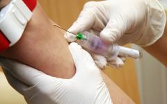 Анемията често се маскира като пролетна умора