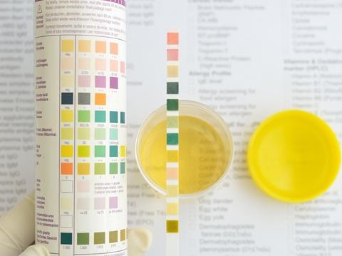 Недостатъчният прием на течности е така опасен, както и прекаляването с тях Недостатъчният прием на течности е така опасен, както и прекаляването с тях