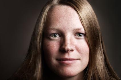 Петната могат да се появят във всяка възраст Пигментни петна