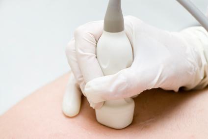 Доплеровата сонография нито е скъпа, нито е опасна за пациента Доплеровата сонография нито е скъпа, нито е опасна за пациента