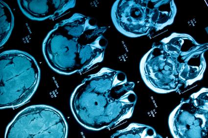 През зимата настъпва хемоконцентрация, тоест сгъстяване на кръвта