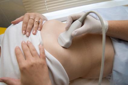 Сравняват изкарването на камъка с раждане